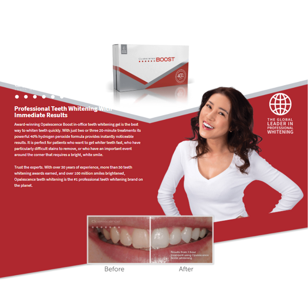 Opalescence Boost 40% PF Ameri - Teeth Whitening Gel Opalescence avis et prix