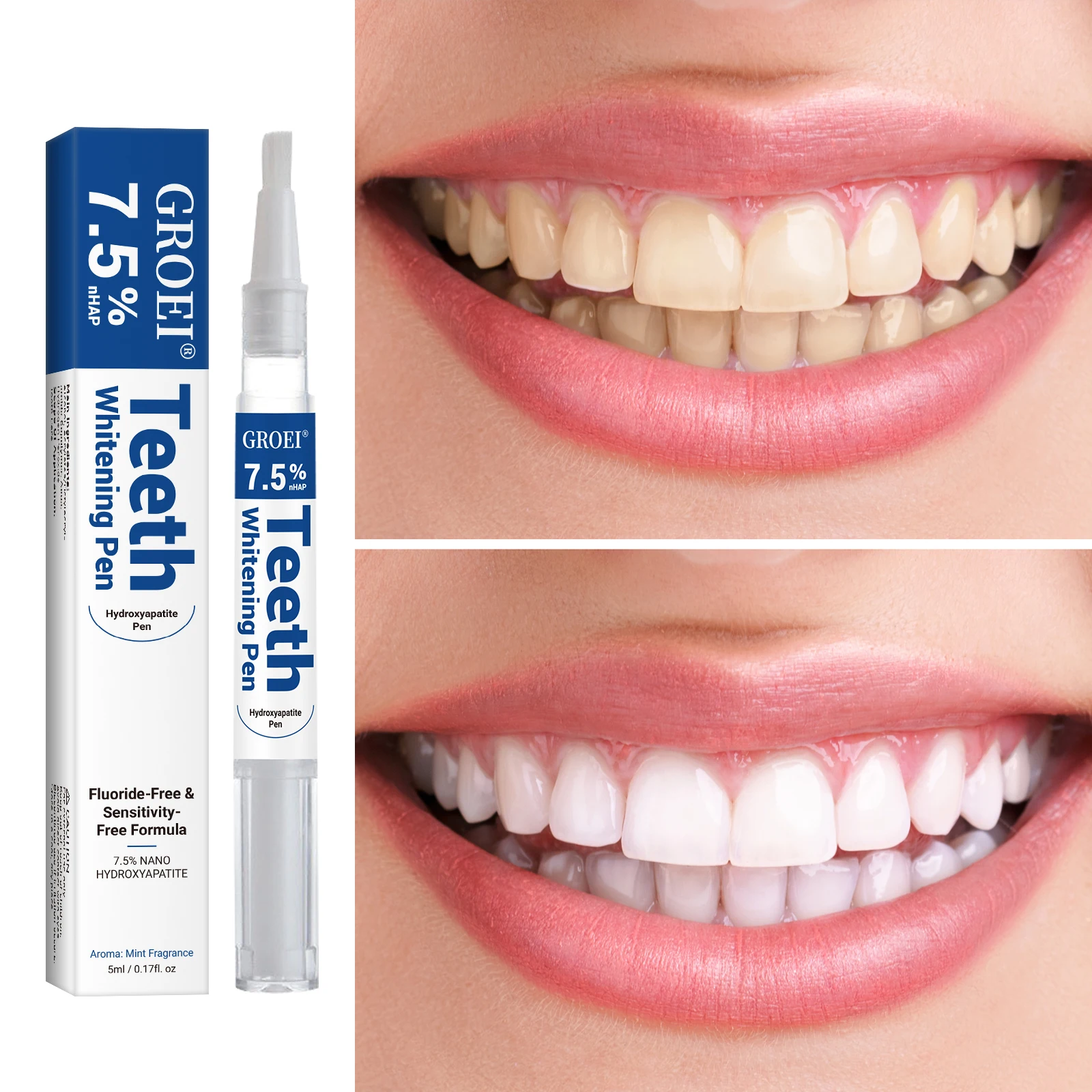 Stylo de blanchiment des dents - Teeth Whitening Gels avis et prix