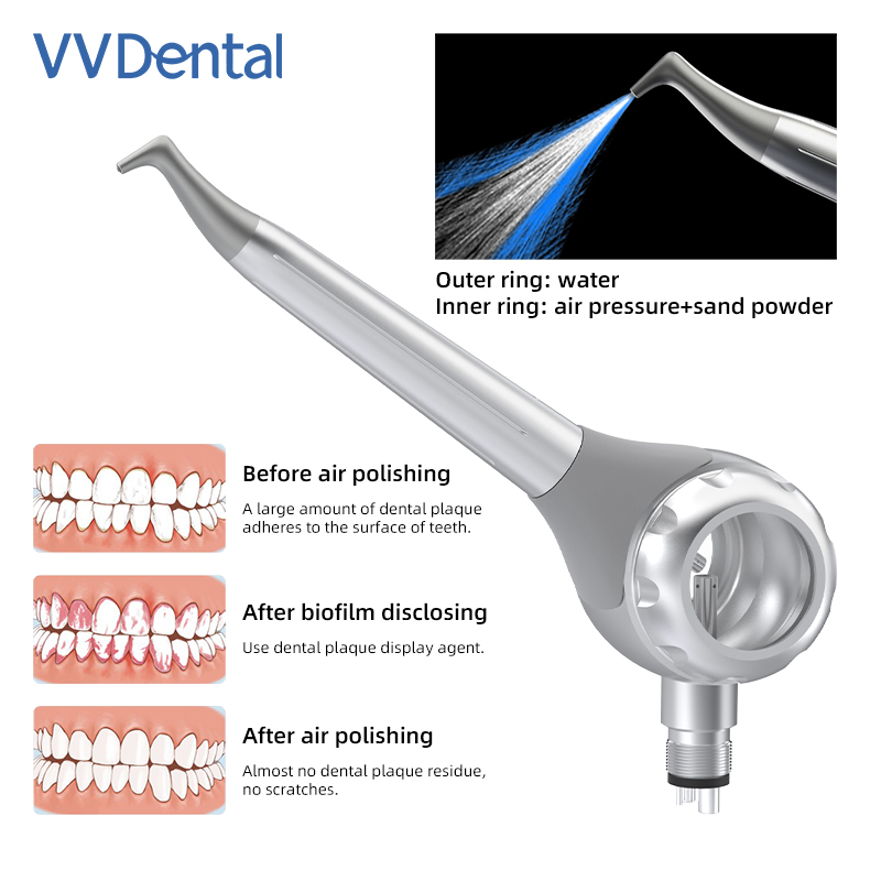 Pistolet de sablage dentaire V - Teeth Whitening Free avis et prix