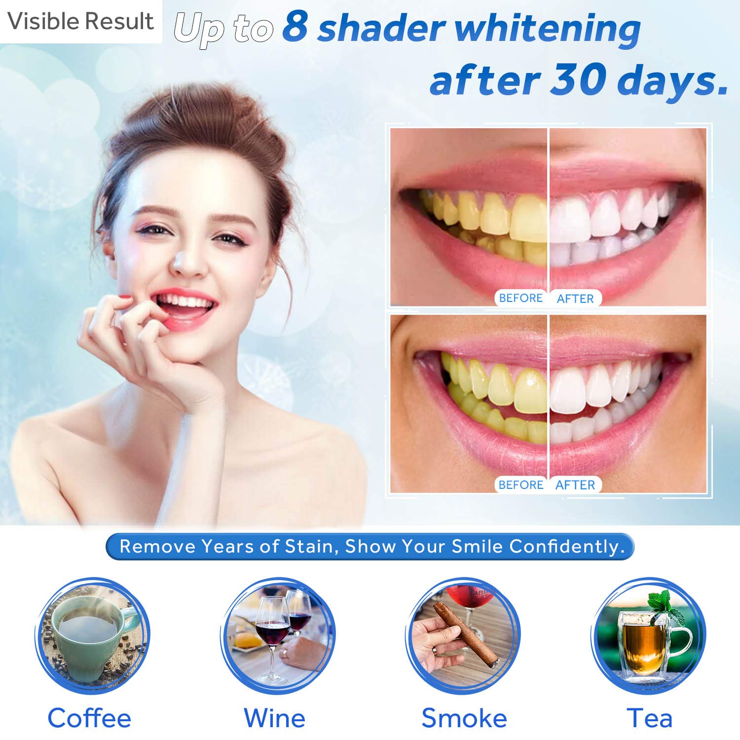 Gel de blanchiment des dents r - Teeth Whitening Gels avis et prix