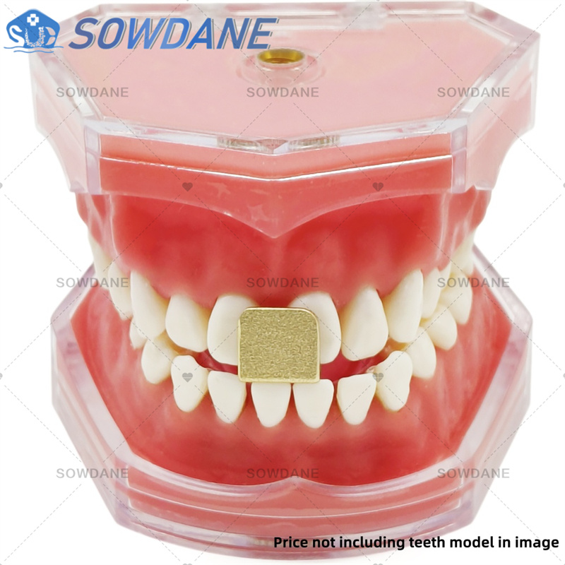 Plateaux d'impression de labor - Teeth Whitening Trays avis et prix