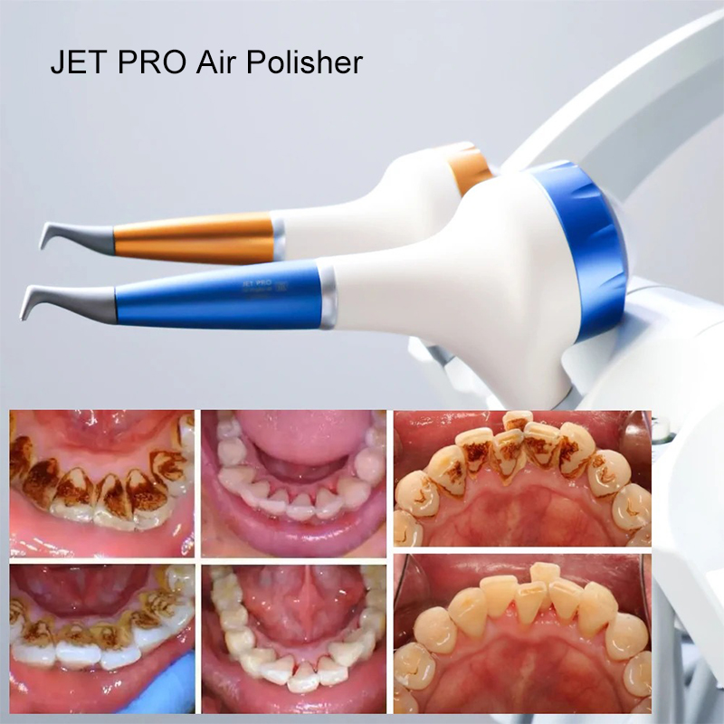 VV Dental Air Polishing Prophy - Teeth Whitening Free avis et prix