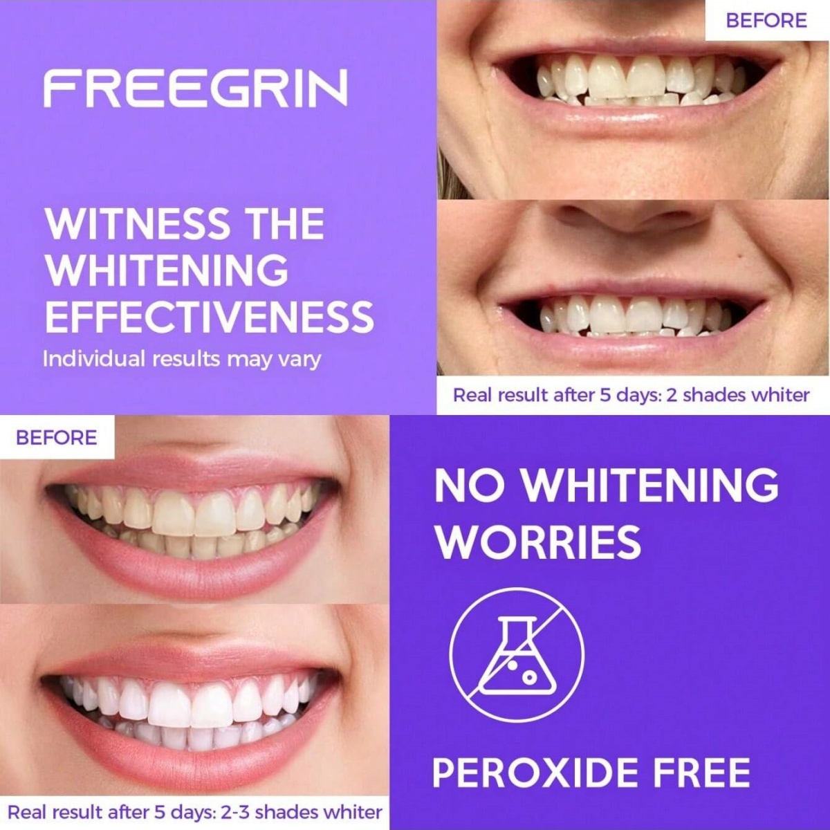 Autocollants de blanchiment de - Teeth Whitening Singapore avis et prix